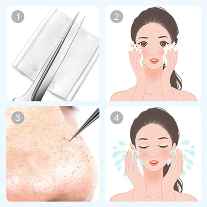 Stainless Steel Blackhead Remover Extractor Tool