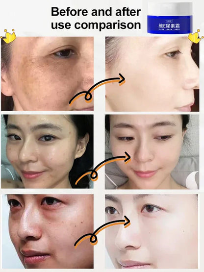 SPOT FADED UREA CREAM